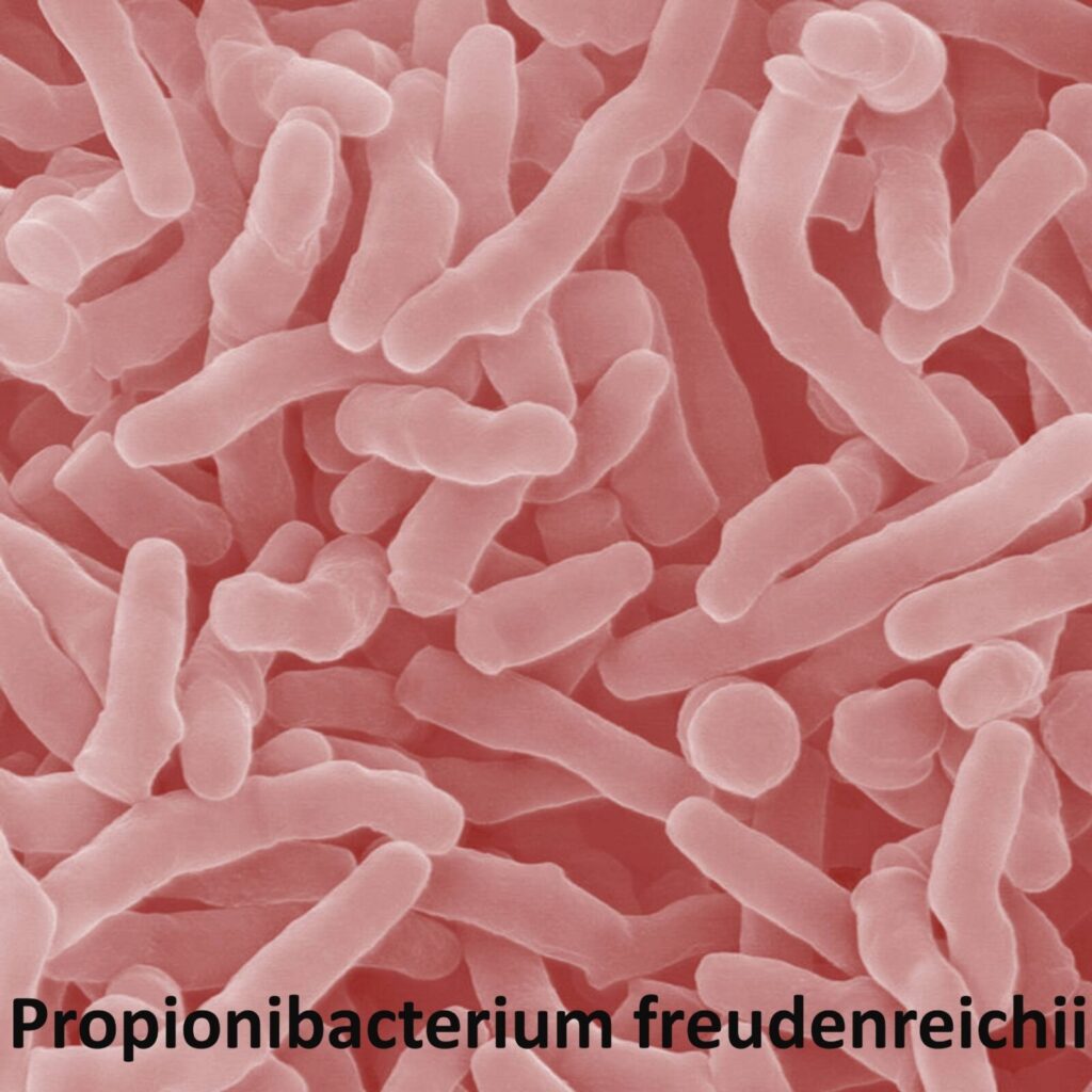 Propionibacterium freudenreichii